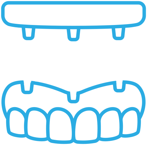 Overdenture